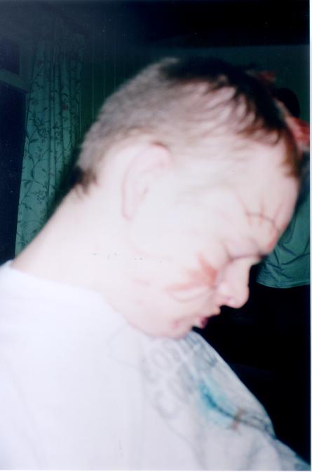 20